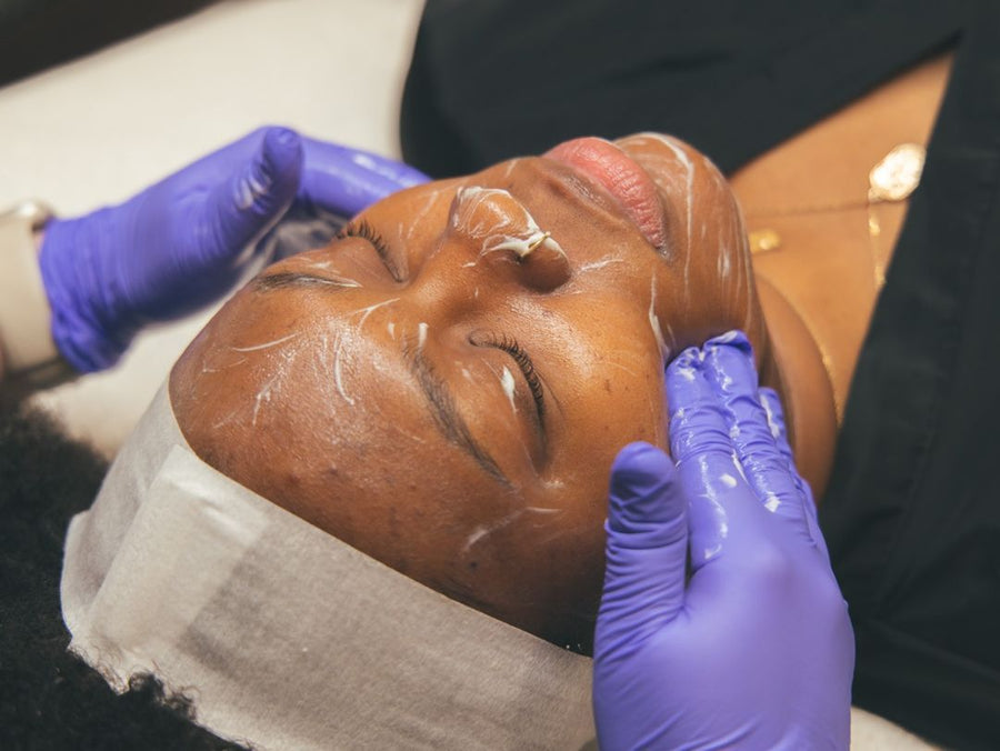 The Lenox Peel