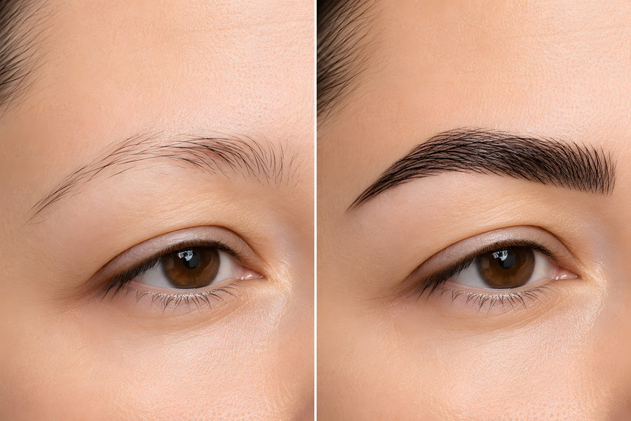 Brow Restoration
