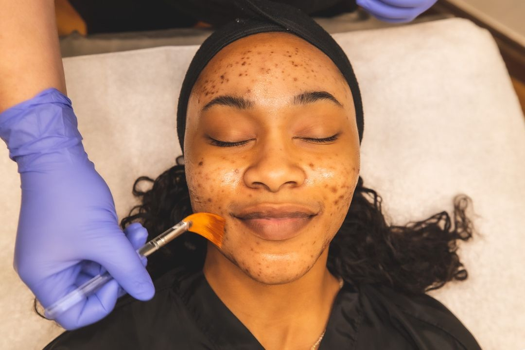 Clearer Skin Begins With Understanding the Pattern.